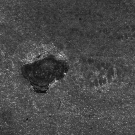 Detecção de defeito de solda do tipo tenção elétrica insuficiente para causar a fusão do material.