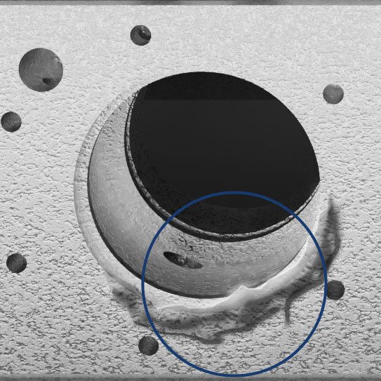 Vision King identificando inchaço